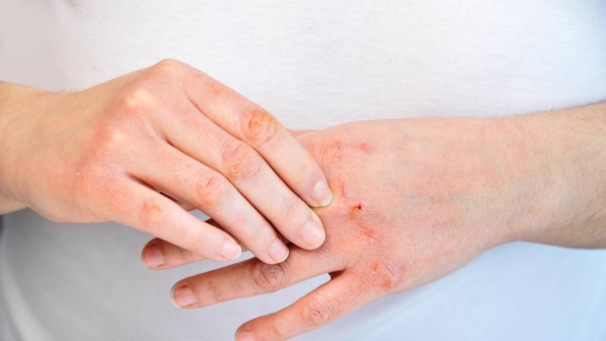 Science reveals the mystery of why some men have longer ring fingers: it's linked to their health.