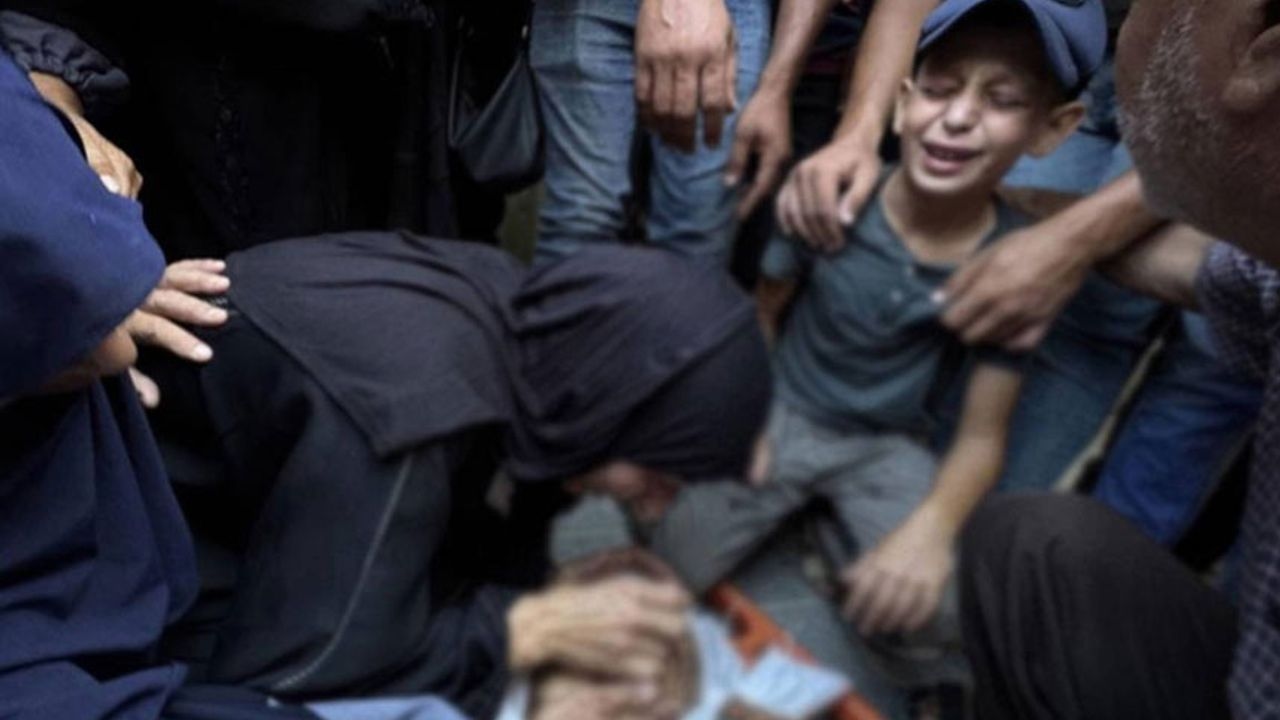 The whole world is watching! 281 people, including 114 children, died of starvation in Gaza