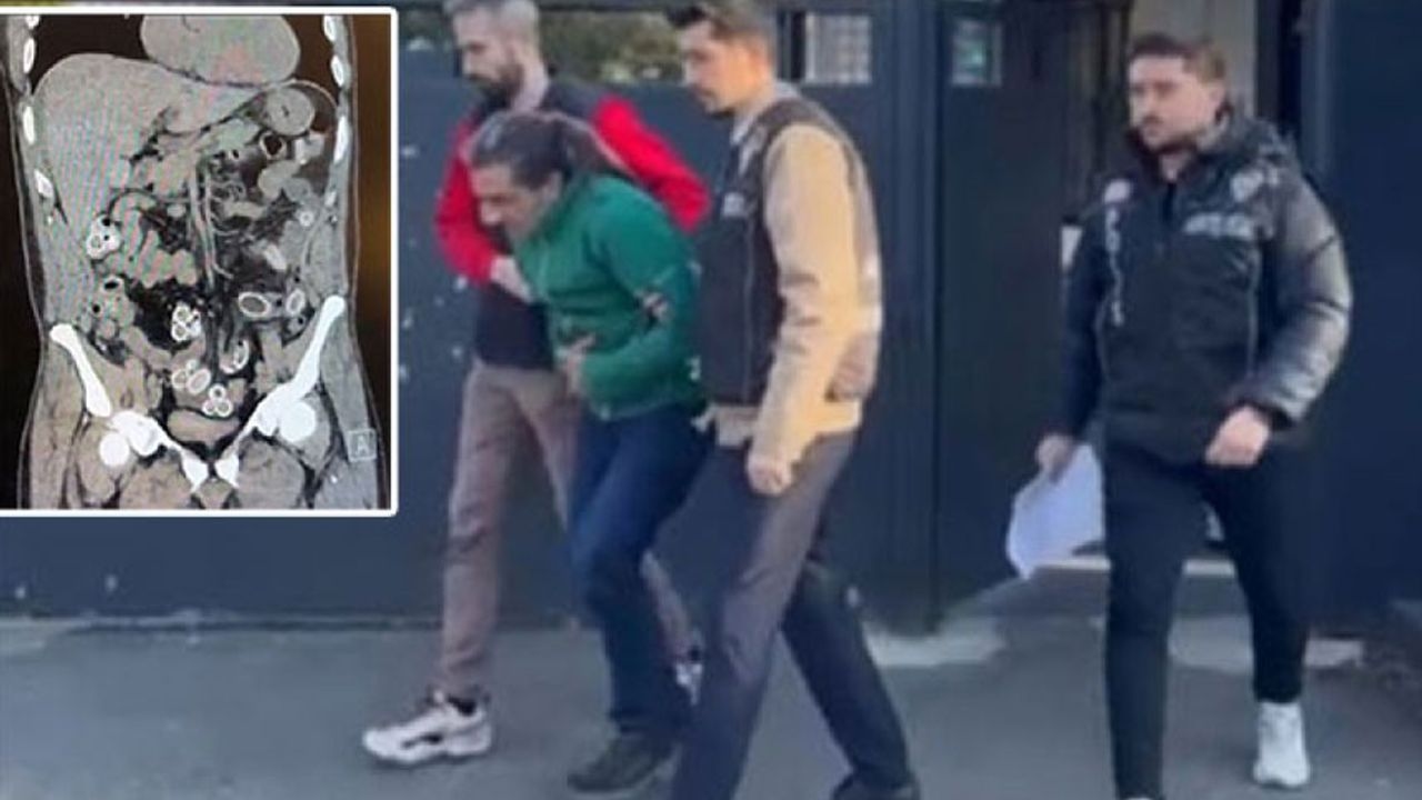 Mide ağrısıyla hastaneye gitti! Polis karnından çıkanları görünce tutuklandı