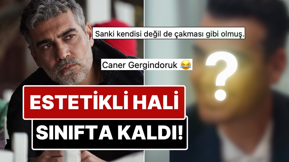 After dyeing his hair and getting his teeth fixed, Caner Cindoruk's latest cosmetic surgery was hard to recognize!