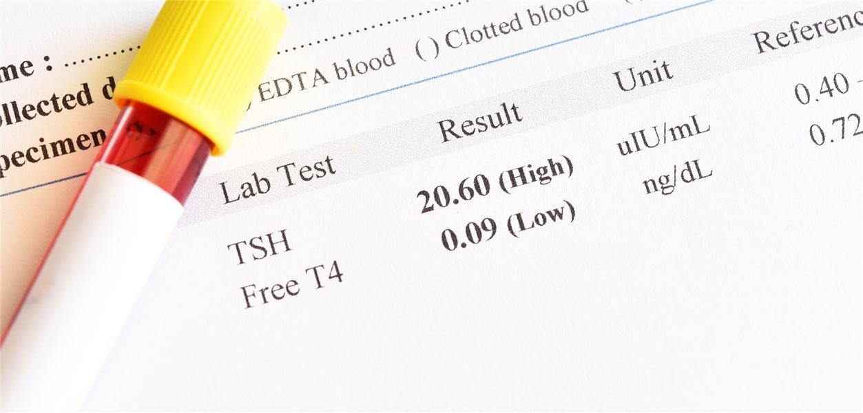Fehldiagnose Hypothyreose bringt Frau in Lebensgefahr